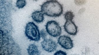 Kalung Antivirus Corona Tak Cukup Bukti, Ahli: Kalau Buat Jualan Emang Laku
