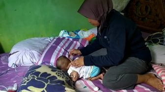 Bima Risky Maulana Lahir Punya 6 Jari, Bibir Sumbing, dan Jantung Bocor