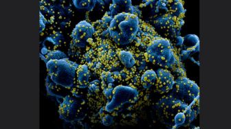 Virus Corona Pemicu Covid-19 Ditemukan pada Makanan Beku Impor