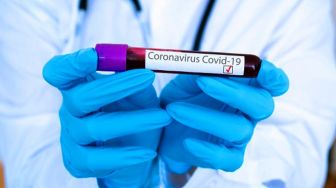 Kota Sukabumi Tertinggi Positif Corona di Jabar Hasil Rapid Test