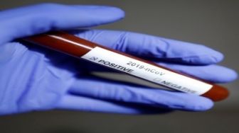 Satu Warga Duri Positif Corona, Camat Mandau Imbau Warga Tidak Panik