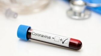 Terus Bertambah, Kasus Corona di Indonesia Capai 3.293