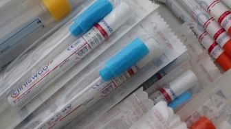 Kasus Positif Covid-19 di Sukabumi, Perbandingan Angka Swab Test Kota dan K