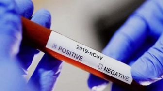 36 Mahasiswa STT Bethel Positif Virus Corona