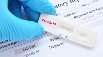 21 Orang Hasil Rapid Test di Babel Hasilnya Reaktif