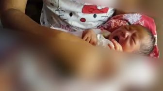 Bayi Lahir Tanpa Dinding Perut, Orang Tua Takut ke RS karena Tak Ada Biaya