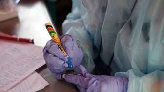 Dari 71 positif corona di Sulut, 39 diantaranya dari Manado