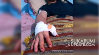 Jadi Korban Salah Sasaran Tawuran di Cicurug, Rizky Dapat 24 Jahitan