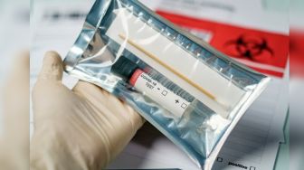 Hasil Swab Keluar, PDP Meninggal Dunia Asal Citamiang Sukabumi Negatif 