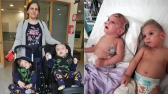 Bayi Kembar Siam Asal Turki Sukses Jalani Operasi di Inggris, Siap Pulang