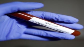 Warga Batam Positif Covid-19, Sempat Dua Bulan Tinggal di Kuansing