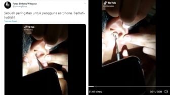 Pengguna Earphone Waspadalah! Video Earbud Nyangkut di Telinga Bikin Ngilu