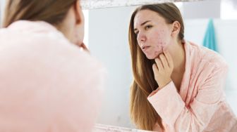 7 Skincare untuk Menghilangkan Bekas Jerawat Paling Ampuh