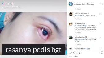 Nangis Sampai Ketiduran, Warganet Curhat Matanya Tak Lagi Berfungsi Normal