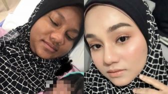 Ngaku Alergi saat Hamil, Paras Wanita Ini Berubah Drastis usai Melahirkan