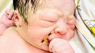 Bayi Ini Keluar dari Rahim Ibunya Sambil Pegang Alat Kontrasepsi