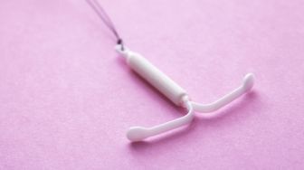 Alat Kontrasepsi IUD Hormonal Lebih Efektif Mencegah Kehamilan daripada Tubektomi