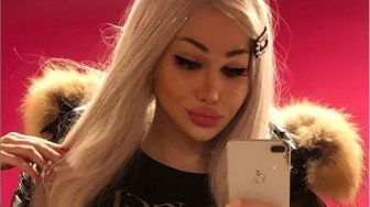 Wajah Barbie Hasil Oplas, Model Ini Curhat Sulit Cari Pekerjaan Normal