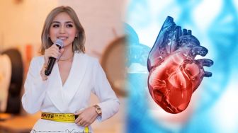 Kenali Penyakit dan Gejala Takikardia yang Diderita Jessica Iskandar