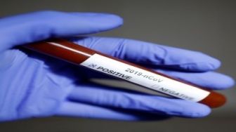 Tiga Cara Sumatera Barat Pertahankan Zona Hijau