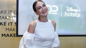 Gips di Kaki Dilepas, Luna Maya Merasa Jalannya Aneh