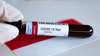 Data Tes Covid-19 Hilang, Ribuan Orang Tak Diinfokan Terpapar Corona