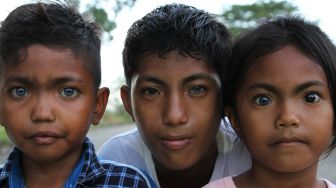 Seorang anak dari Suku Buton, Eni Wahyuni menunjukan bola mata berwarna biru dan kemerahan di Kendari, Sulawesi Tenggara, Rabu (16/9/2020). [ANTARA FOTO/Jojon]