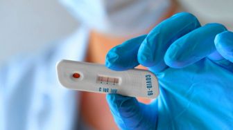 Empat Tenaga Medis dari 4 Puskesmas di Cianjur Reaktif Covid-19