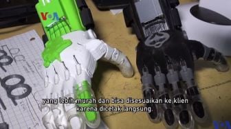 Inovasi Canggih Mahsa Riar, Ciptakan Prostetik dengan Printer 3D