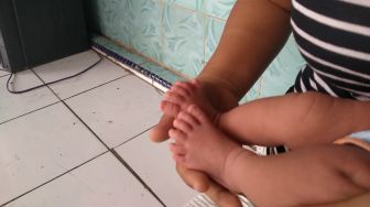 4 Fakta Unik Bayi Galuh Jagalullah Punya 12 Jari Tangan dan kaki