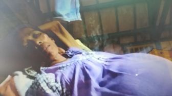 Tumor, Emak Miskin di Kab. Serang Hanya Dibiarkan Terbaring di Rumahnya