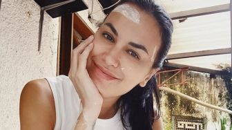 Sophia Latjuba Pamer Foto Rontgen, Netizen: Pantes Cakep, Wajahnya Simetris