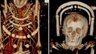 Ilmuwan Intip Organ Dalam dan Otak Mumi Berusia 400 Tahun