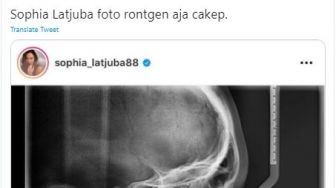 Beredar Foto Rontgen Sophia Latjuba, Publik Kagum Lihat Tulangnya