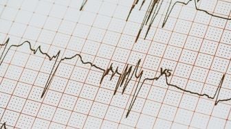 Gara-Gara Telan Baterai, Alat EKG Salah Deteksi Serangan Jantung