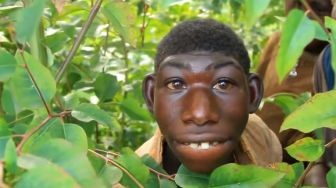 5 Fakta Zanziman Ellie, Pemuda yang Dijuluki Tarzan di Dunia Nyata