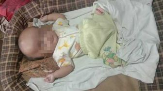 Derita Hidrosefalus, Bayi 2 Bulan di Tualang Butuh Donasi untuk Pengobatan