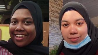 Dulu Kulitnya Gelap, Wanita Ini Viral usai Sukses Jadi Glowing dan Putih