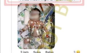 Beredar Foto Bayi Korban Vaksin COVID-19, Tubuh Penuh Infus, Benarkah?