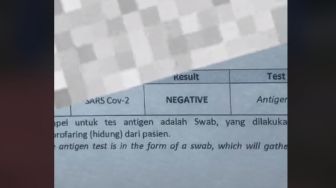 Viral Pelanggan Belum Di-swab tapi Sudah Dapat Hasil, Farmalab Minta Maaf