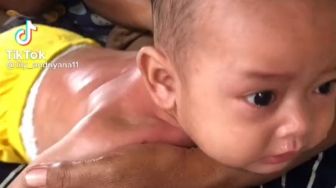 Viral Bayi Histeris Kerokan Pakai Bawang Merah, Warganet Berdebat
