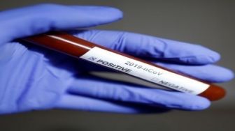 Warga Riau Meninggal Karena Covid-19 Bertambah 4 Orang 