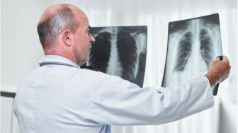 Perjualbelikan Hasil X-ray Pasiennya, Dokter Bedah Ini Dilaporkan Penyintas