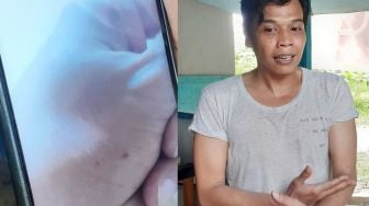 Ngeri! Warga Tangsel Digigit Kobra, Terasa Melepuh dan Tangan Mati Rasa