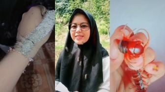 Viral Gadis Hobi Ditempeli 'Ratu' Ulat Bulu di Sekujur Tubuh, Merinding!