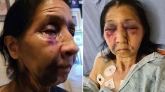 Disangka Keturunan Asia, Seorang Nenek Dianiaya hingga Patah Hidung