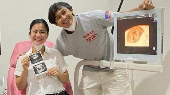 Pamer Wajah Via USG, Anak Felicya Angelista Mirip Siapa?