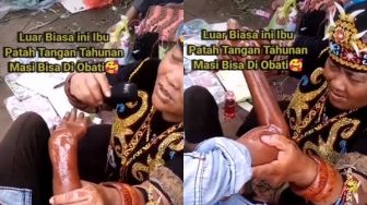 Viral Detik-Detik Wanita Dayak Sembuhkan Tangan Patah Tulang, Bikin Ngilu