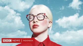 Kisah Perempuan Albinisme yang Dibuang Saat Bayi, Kini Jadi Model Vogue