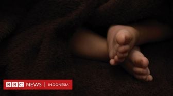 Bayi Kembar 9 Dilahirkan Perempuan Mali, Hanya 7 Terlihat di Pemindai